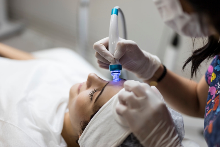 Dermapen Nedir, Ne İşe Yarar?-3 - Saç Bakım Güzellik