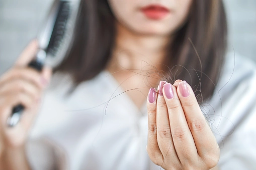 Kadınlarda Saç Dökülmesi için Bakım Önerileri-5 - Saç Bakım Güzellik