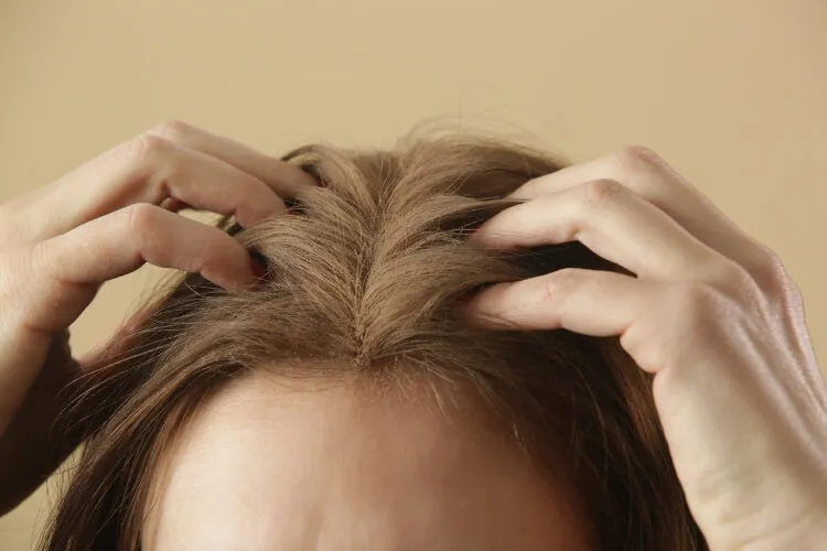 Saç Dipleri Ağrısı Hakkında Bilmeniz Gerekenler-1 - Saç Bakım Güzellik
