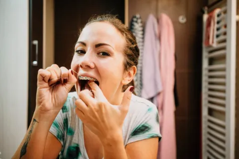 Diş Teli Olanlar İçin Ağız Bakım Önerileri-4 - Saç Bakım Güzellik