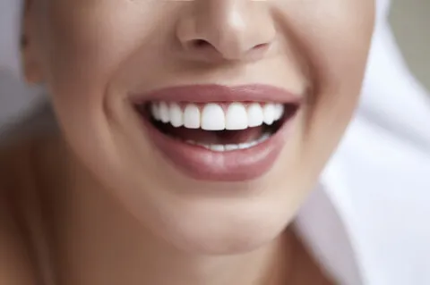 Kusursuz Bir Gülümseme İçin Dişlerinize İyi Bakın-4 - Saç Bakım Güzellik