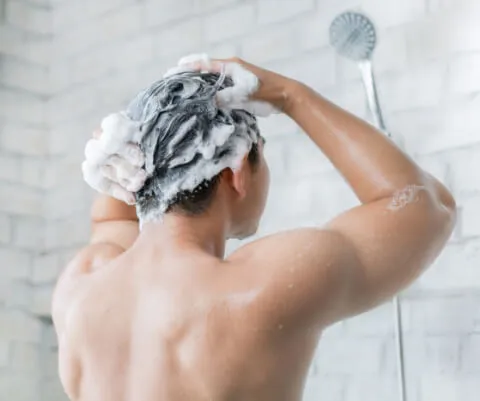 Erkeklerin Büyük Sorunu: Saç Dökülmesi -2 - Saç Bakım Güzellik