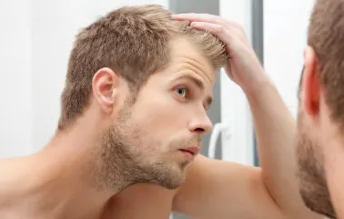 Erkeklerin Büyük Sorunu: Saç Dökülmesi  - Saç Bakım Güzellik
