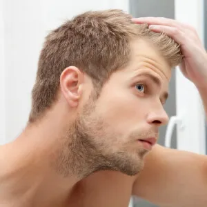 Erkeklerin Büyük Sorunu: Saç Dökülmesi  - Saç Bakım Güzellik