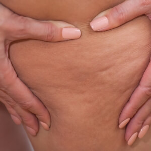 Kollardaki Sivilceler Hakkinda Bilmeniz Gereken Her Sey Sac Bakim Guzellik